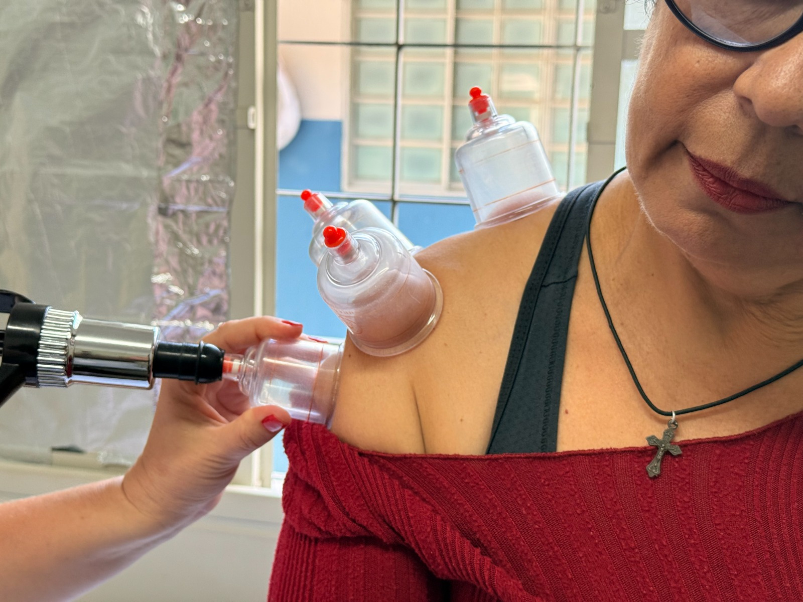 Acupuntura gratuita em Goiânia: SUS oferece tratamento para ansiedade, dores e insônia